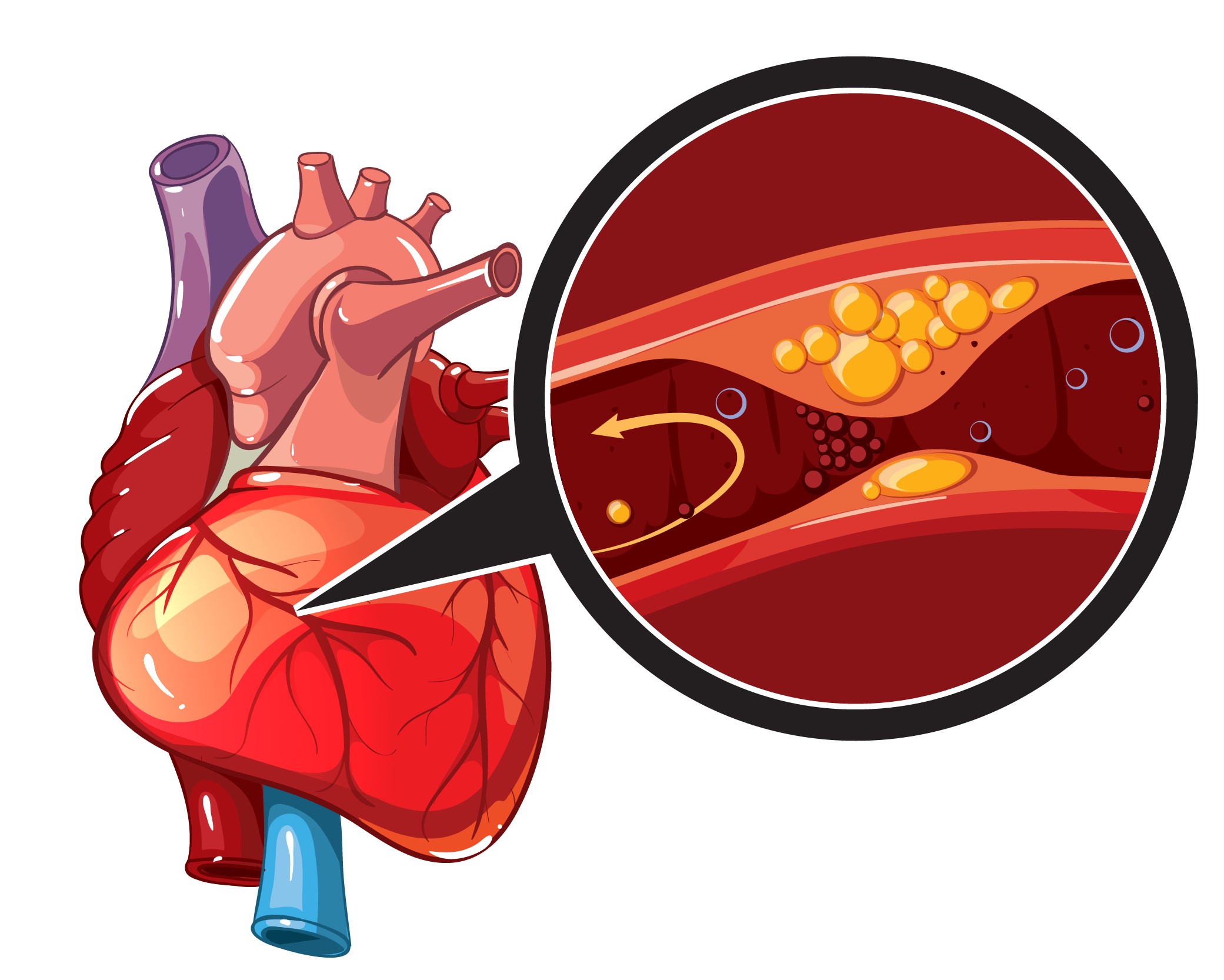 13381416_1511.m10.i304.n038.S.c12.330784109 Heart disease vector infographics.jpg